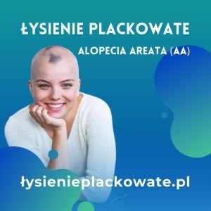 alopecia-miniatura1